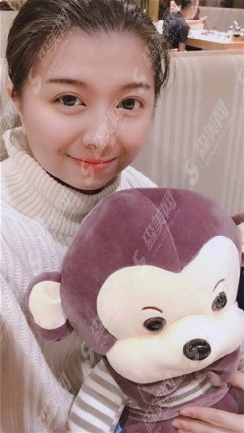 北京八大处做拉皮哪个医生好?侯典举、杨明勇、马继光都是拉皮整形的大牛人。