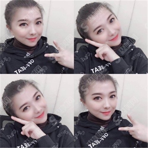 北京八大处做拉皮哪个医生好?侯典举、杨明勇、马继光都是拉皮整形的大牛人。