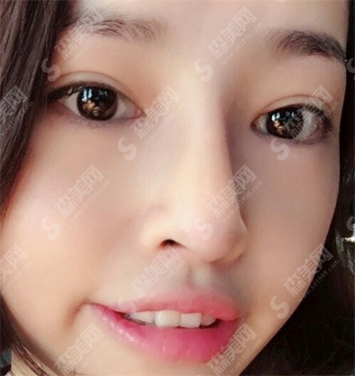 上海九院做双眼皮哪个专家比较好,苏薇洁,张余光,谢峰光荣上榜。