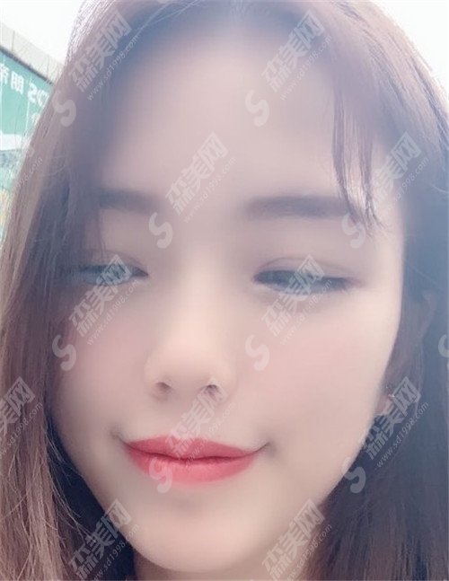 郑州美丽时光整形医院杨瑞国好吗?医院什么情况?亲身案例有没有?