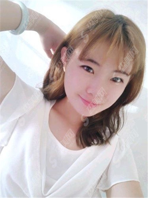 煤炭总医院王驰技术有多好?煤炭总医院有多牛?案例和价格表什么情况?