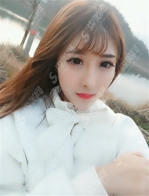 哈医大二院整形外科刘国锋整形医生手出芙蓉技术了得,看了案例就会深有体会