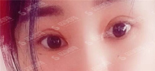 武汉双眼皮修复医生排名前十名单,孙家明、王海平,曹玮占据前三!