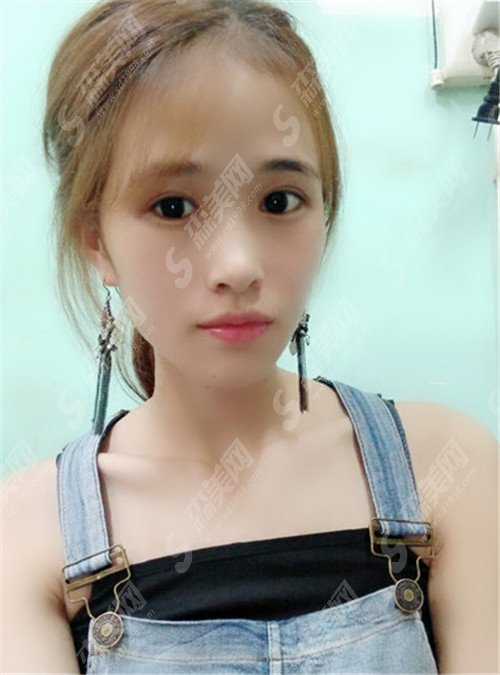 北京面部提升专家排名前五强都有谁?杨大平,祝东升,李晓东都在榜上!