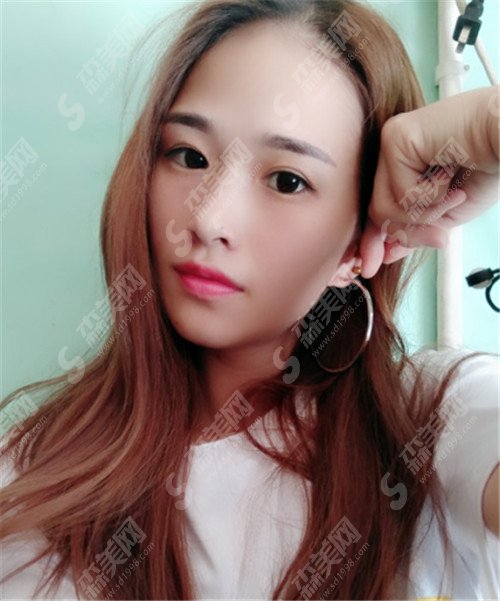 北京面部提升专家排名前五强都有谁?杨大平,祝东升,李晓东都在榜上!