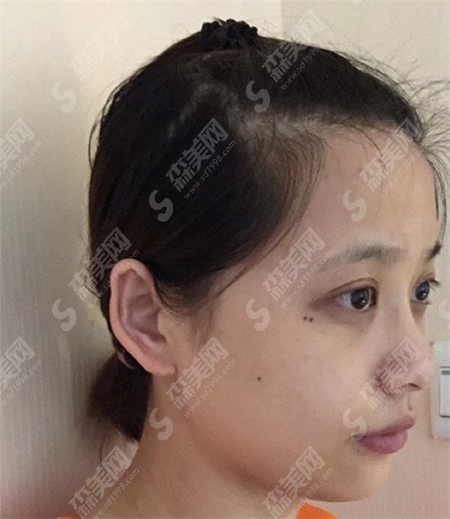 上海九院鼻修复专家医生排名出炉!钱云良,李青峰,魏皎位居前三甲!