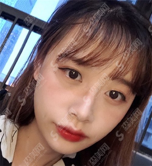 上海九院鼻修复专家医生排名出炉!钱云良,李青峰,魏皎位居前三甲!