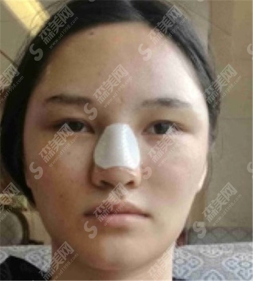 浙二医院胡学庆怎么样?医院可靠吗?有没有案例和价格表公开一下?