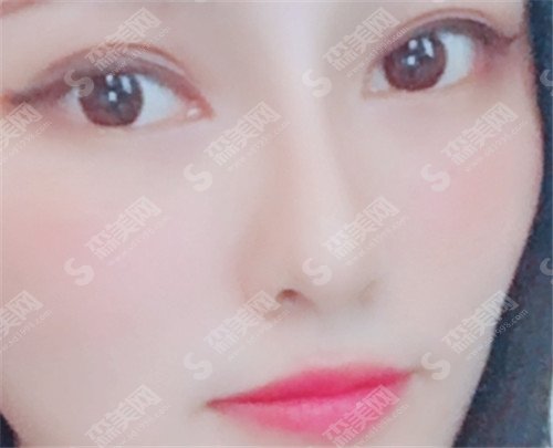 浙二医院胡学庆怎么样?医院可靠吗?有没有案例和价格表公开一下?