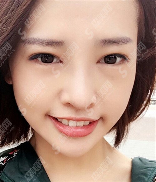 邯郸华美整形医院怎么样?医院专家+成功案例(附价格表)