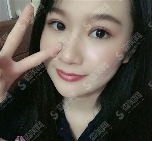 银川附属医院整形价格表公布啦,医院医生展示+案例(带照片)