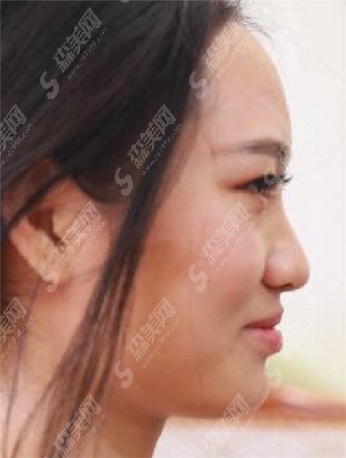 上海九院李青峰怎么样?海九院好吗?有没有成功的案例分享&价格表