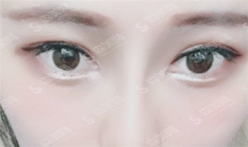 上海九院李青峰怎么样?海九院好吗?有没有成功的案例分享&价格表