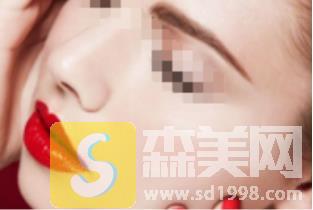 上海余天成医院厚唇改薄果怎么样?靠谱吗?做完立马变得性感可人