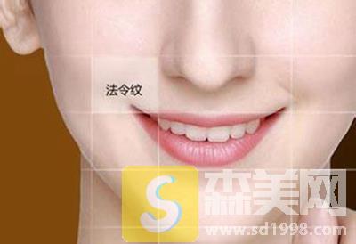 祛法令纹激光好不好?益阳瑞澜整形激光去法令纹真的不得了