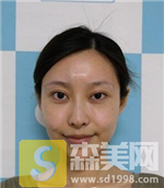 上海九院许志成除皱怎么样