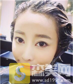九院许志成除皱怎么样