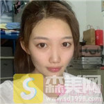 成都伊生美自体脂肪全脸填充怎么样?填充项目价目表+相关案例展示