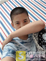 成都恒博植发兰京种植发际线怎么样？相关案例展示+2021项目价目表