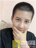 成都恒博植发兰京种植发际线怎么样？相关案例展示+2021项目价目表