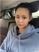 成都赵善军博士自体脂肪全脸填充好不好?填充案例前后对比+2021项目价目表