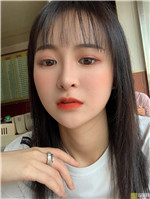 成都赵善军博士自体脂肪全脸填充好不好?填充案例前后对比+2021项目价目表