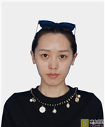 北京叶美人丁雅晴自体脂肪全脸填充如何?2021项目价目表+相关案例展示