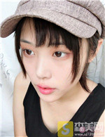 天津耶利亚自体脂肪全脸填充怎么样?填充案例果+2021项目价目表