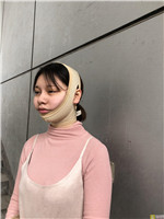 厦门欣医美医疗美容做面部吸脂怎么样？2020价格表曝光+面吸真人案例分享