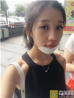 杭州华山连天美姜鑫利垫下巴怎么样?垫下巴真人案例果+2021项目价格表