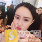 成都恒博植发种植发际线好吗?种植发际线四个月果分享