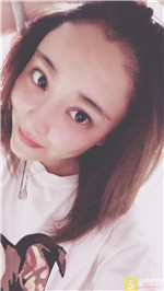 [大麦微针植发]北京总院殷灿昌种植发际线怎么样？附真人案例展示