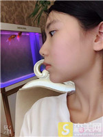 宁波韩美美容医院硅胶垫下巴怎么样?硅胶垫下巴案例果_2021项目价目表