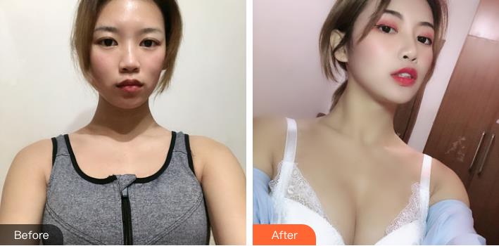 深圳美莱郭杰医生的相关案例和介绍