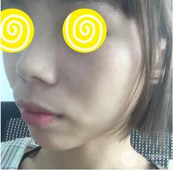 整形专家何秀怎么样?案例展示和个人主页