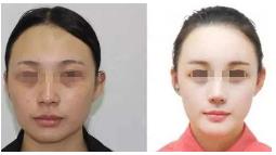 刘唯技术怎么样?案例展示和个人主页