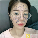 北京禾美嘉任学会做自体脂肪填充怎么样?加一个案例分享及2021项目价格表