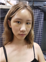 北京禾美嘉整形美容怎么样?附较新2021年价格表，自体脂肪填充案例