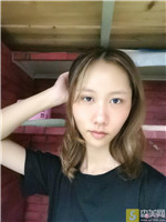 北京禾美嘉整形美容怎么样?附较新2021年价格表，自体脂肪填充案例