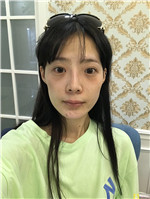 北京润美玉之光朱金成医生怎么样？相关案例_2021年价格表发布