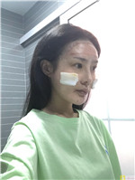 北京润美玉之光朱金成医生怎么样？相关案例_2021年价格表发布