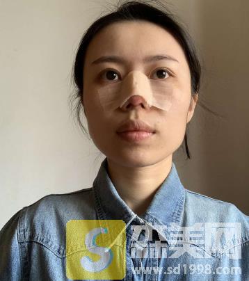 沈阳军区总医院整形科怎么样?医生名单+隆鼻案例+医院简介