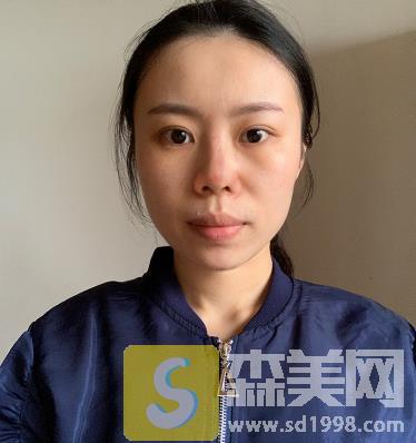 沈阳军区总医院整形科怎么样?医生名单+隆鼻案例+医院简介