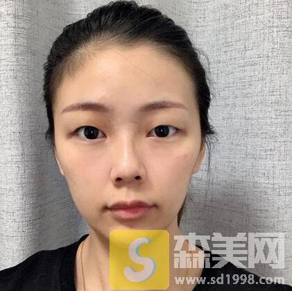 包头第四医院整形美容科怎么样？内附案例展示+价格表一览