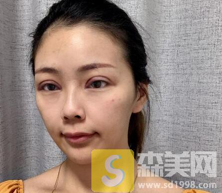 包头第四医院整形美容科怎么样？内附案例展示+价格表一览