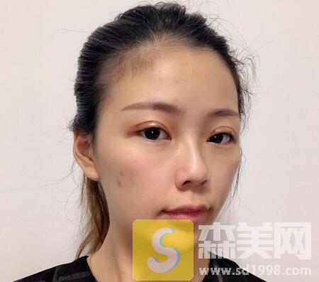 包头第四医院整形美容科怎么样？内附案例展示+价格表一览