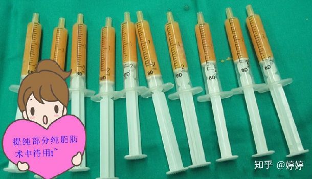 整形必看|做自体脂肪隆胸需要什么条件？