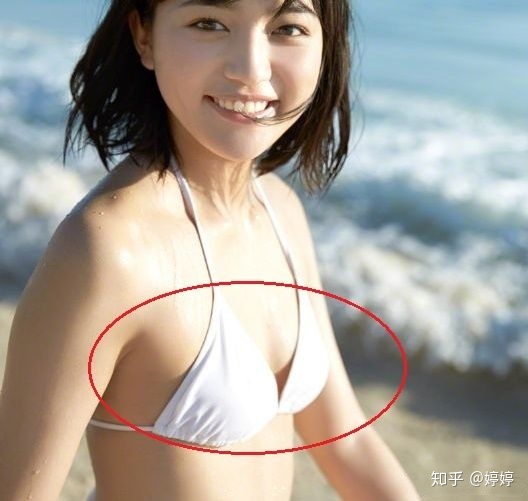 整形必看|做自体脂肪隆胸需要什么条件？