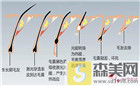 脸部激光脱毛价格