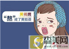 如何去黄褐斑比较有？